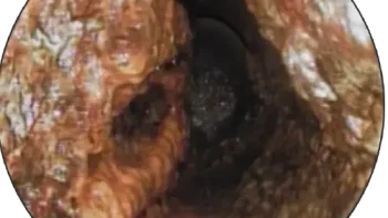 Sewer-Robotics-grease-e1645029499997